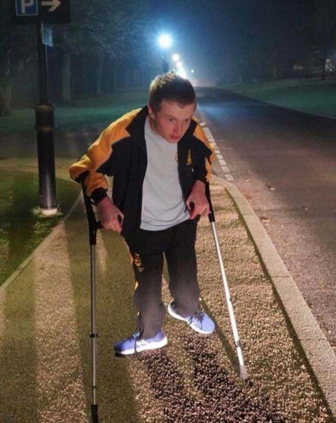 Serebral Palsi: Tanım, Belirtiler ve Tedavi Yöntemleri