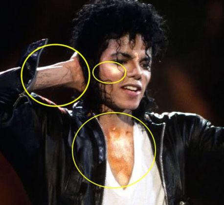 Michael Jackson Hakkında Yanılgılar Ve Sansasyonlar