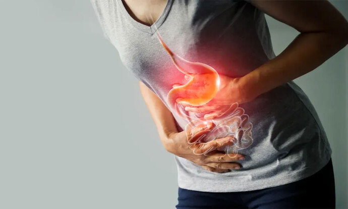 Sinirli Mide, Huzursuz Mide, Sinirsel Gastrit. Midende Kelebekler mi Uçuşuyor? Yoksa Filler mi Koşuşturuyor?