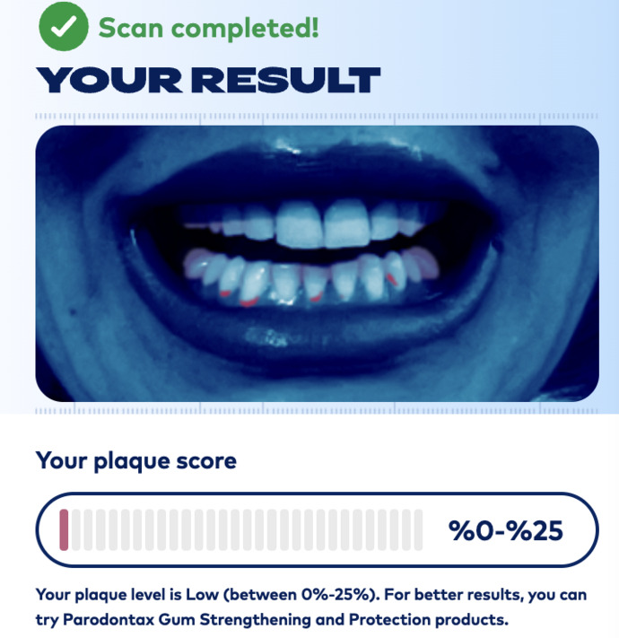 Parodontax, Türkiye’de Ağız Bakım Kategorisinde Bir İlk Olan Yapay Zeka Destekli “Plak Check” Uygulamasını Hayata Geçirdi!