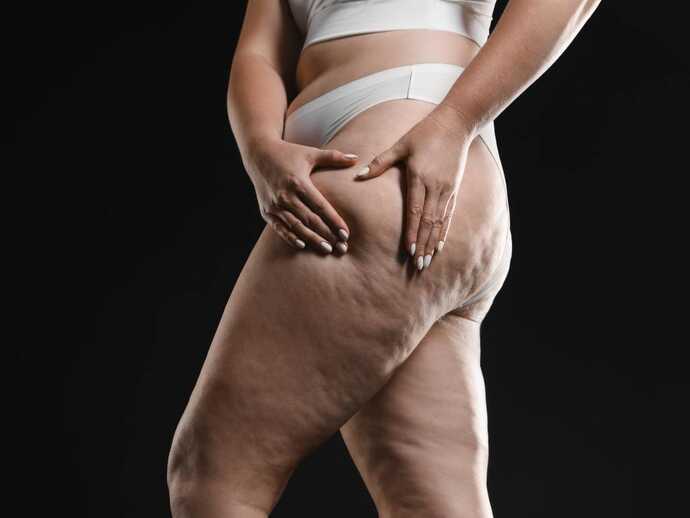 Lipodem İçin İdeal Beslenme