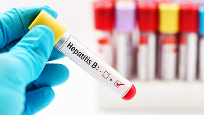 Sessiz ve Derinden Giden Tehlike: Hepatit Hakkında Bilmeniz Gereken Her Şey! 💛