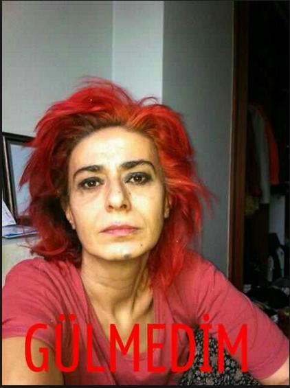 Capslere Malzeme Olan Ünlüler - 2