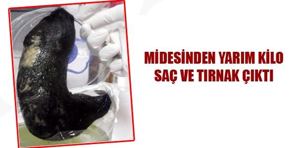 Yaza Fit Girmek İçin Bunları Yemeyin.!