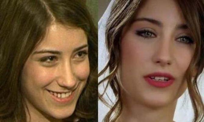 Ünlülerin Makyajsız Halleri