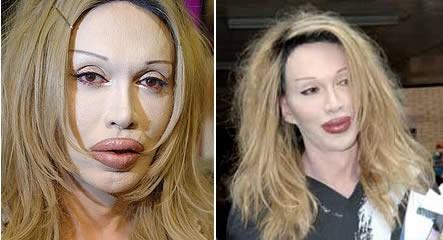 Estetik Faciaları