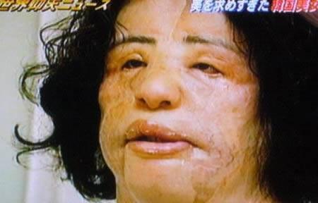Estetik Faciaları