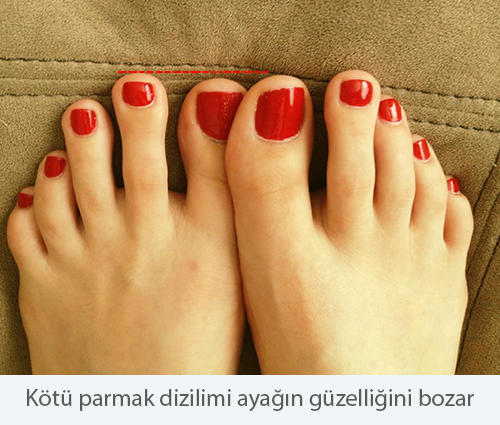 Ayak Fetişizmi, Güzel Ayak Nedir?