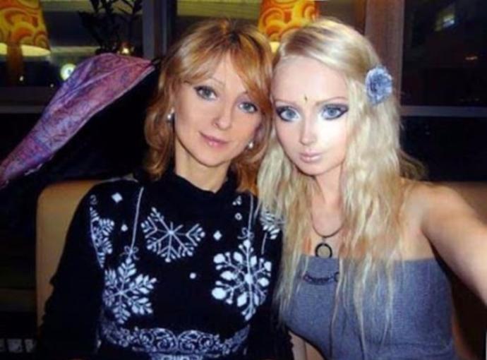 Estetik Hastalığı; Yaşayan Barbie Valeria