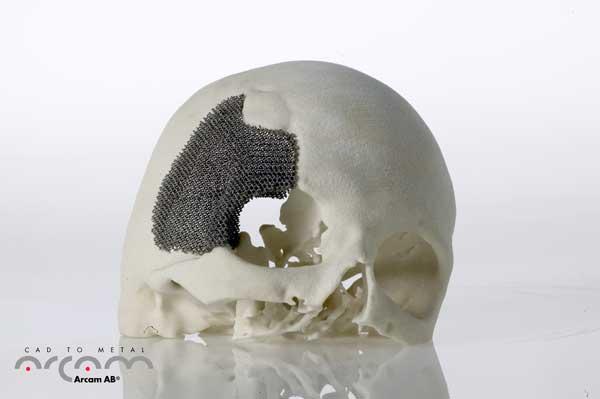 Geleceğin Teknolojisi Hızlı Prototipleme -3D Yazıcı - Eklemeli İmalat