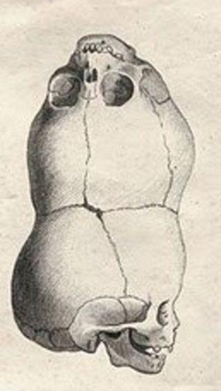 Nadir Görülen Hastalıklar (Hassas Görseller Içerir)