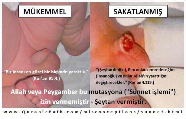 Erkeklerin sünnet olması hakkında ...