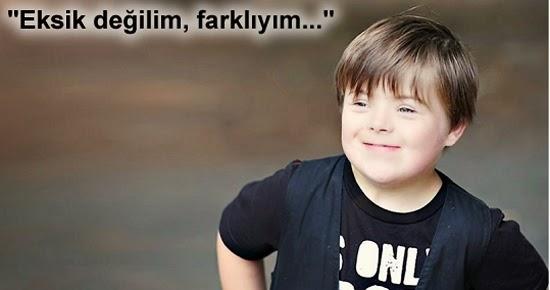 Down Sendromlu Olmak ve Farkındalık