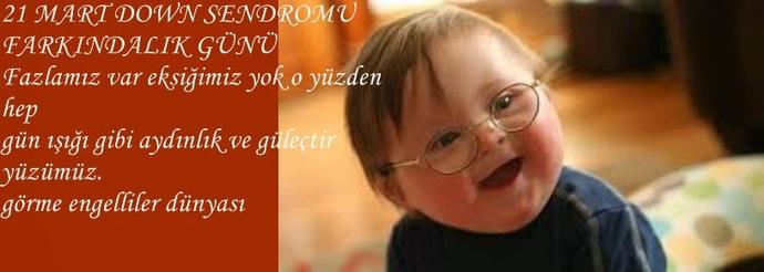 Down Sendromlu Olmak ve Farkındalık