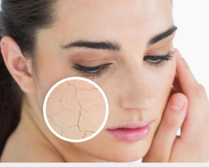 Kuru Ciltlerin Kurtarıcısı Olacak Maske Tarifi!