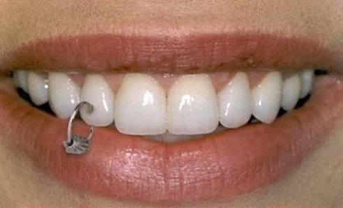 Piercing Olayını Abartanlar