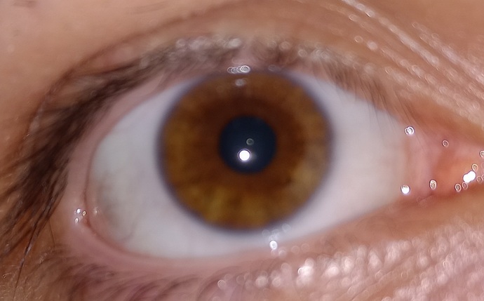 Kehribar (Amber) Göz Rengi - KizlarSoruyor