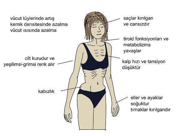 ben aneroksiyayı nasılmı yendim?
