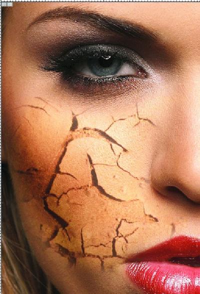 Vücuttaki Çatlaklara Doğal Maske Tarifi İçerir!