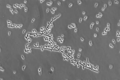 Kadınlarda Genital Enfeksiyonlar
