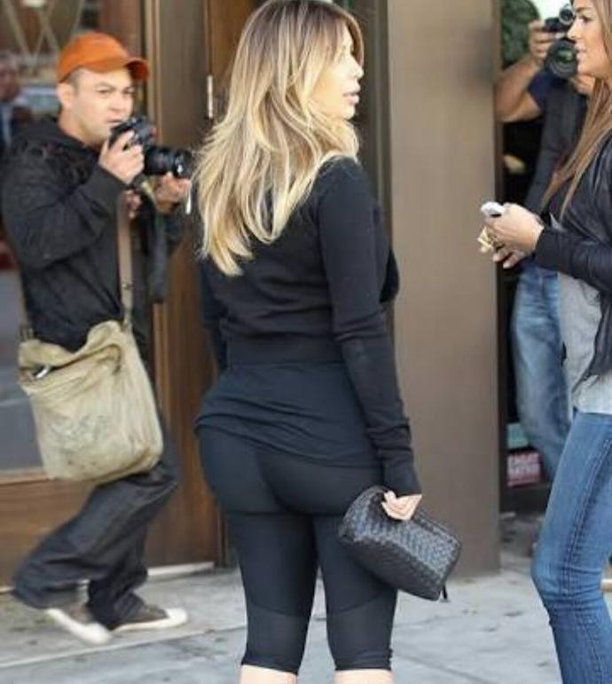 Kim Kardashian'ın Estetik Hikâyesi