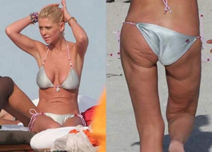 Photoshop Güzellerinin Gerçek Hayattaki Halleri
