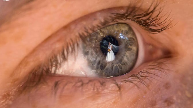 Gözdeki Yansımalarla Çekilen İnanılmaz Düğün Fotoğrafları