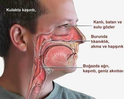 Alerjiniz Varsa Bunları Yapın, Yoksa Daha da Çok Yapın