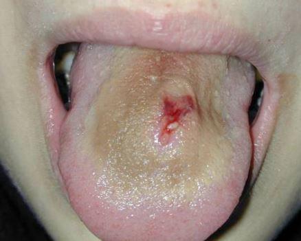 Piercing Kullanımı ve Bilgiler