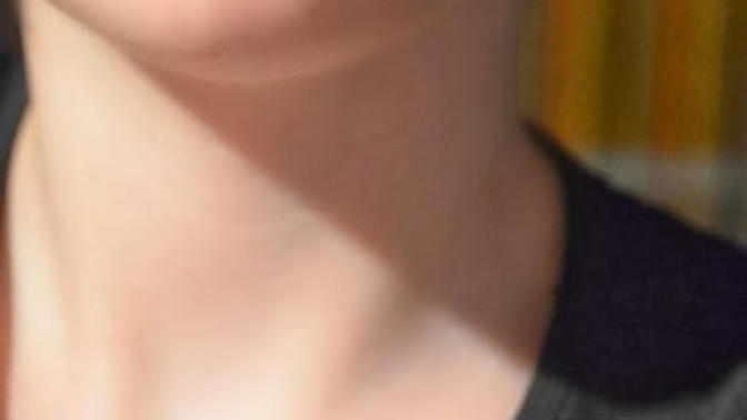 Dudak Piercing'i Hakkında Gereksiz Abartılar