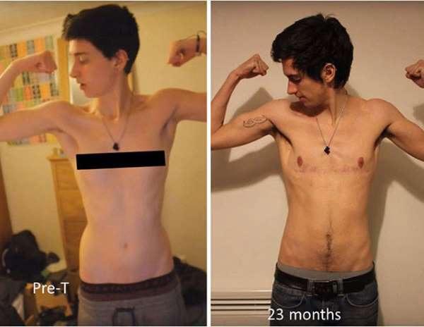 Cinsiyet Değişimini Adım Adım Fotoğrafladı! Sonuç Muazzam!