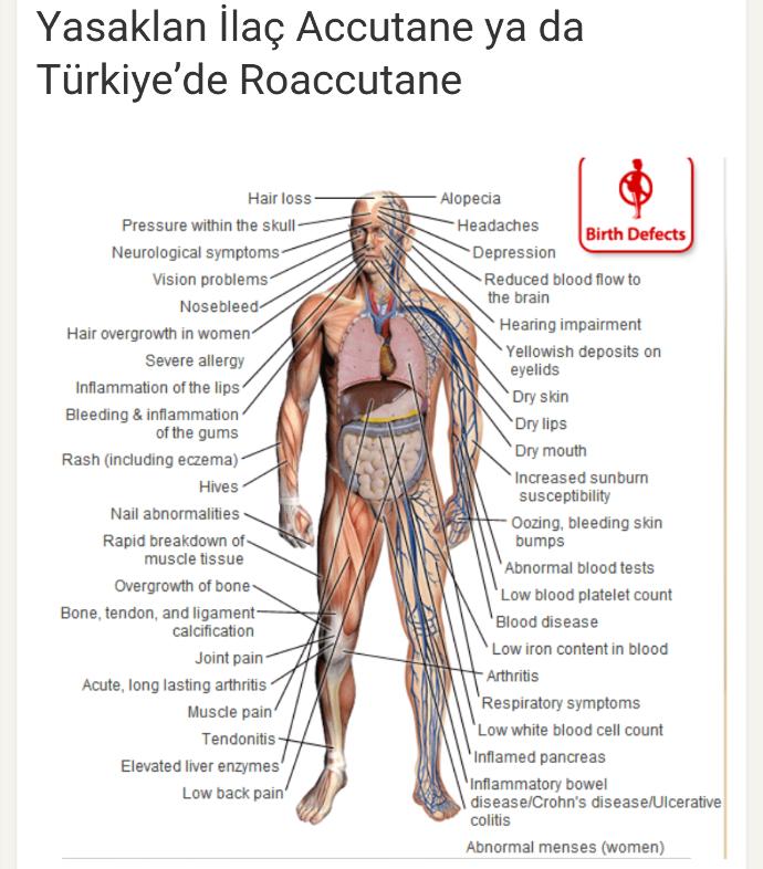 Zoretanin, Roaccutane ve Acnetrend hakkında bilinmesi gerekenler
