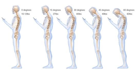 Akıllı Telefonlar ve Dizüstü Bilgisayarların Vücuda Zararlarını Biliyor musunuz?