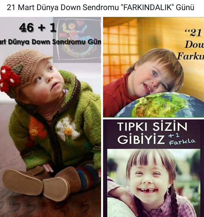 💙21 Mart Dünya Down Sendromu