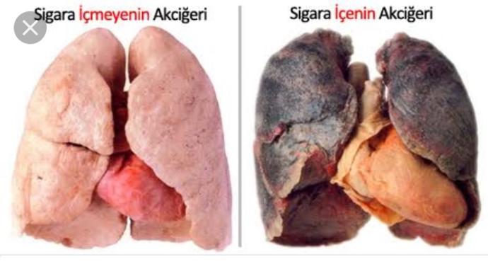 Sigaranın Faydaları!