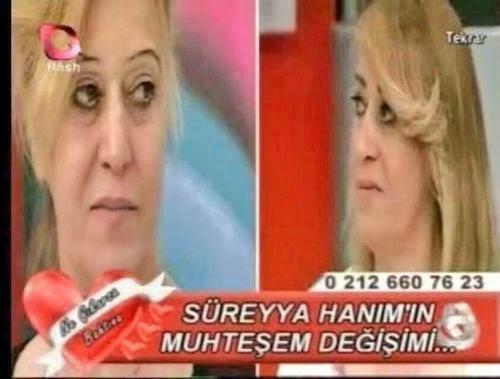 Olumsuz Evrim Geçiren Ünlüler