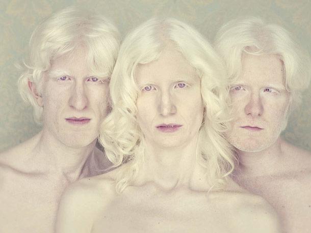Albino Hastalığının Hayvanlardaki Güzel Görüntüsü