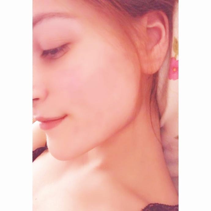 Sivilceler mi? Çare Roaccutane