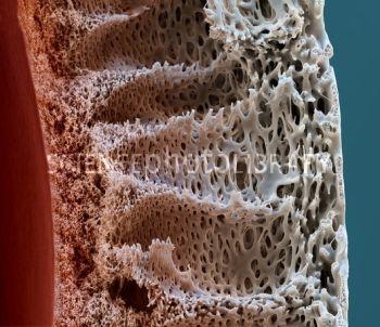 Tuhaf Bir Fobi: Trypophobia