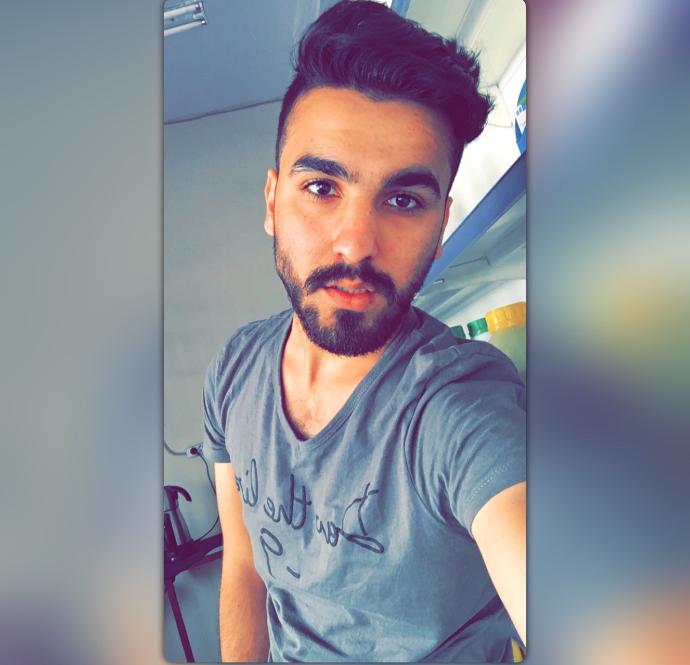 5 Adımda Siyah Noktalarınızdan Kurtulun