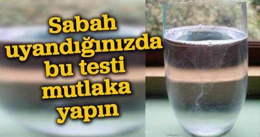 Böyle kolay test görmedim