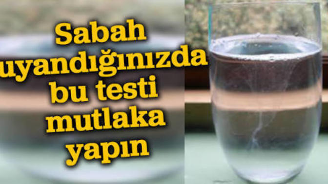 Böyle Kolay Test Görmedim!