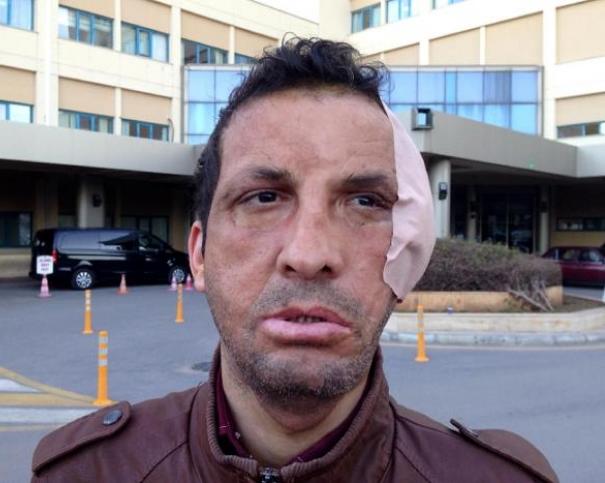 Beyin Bedava ise Gülmek de Bedava