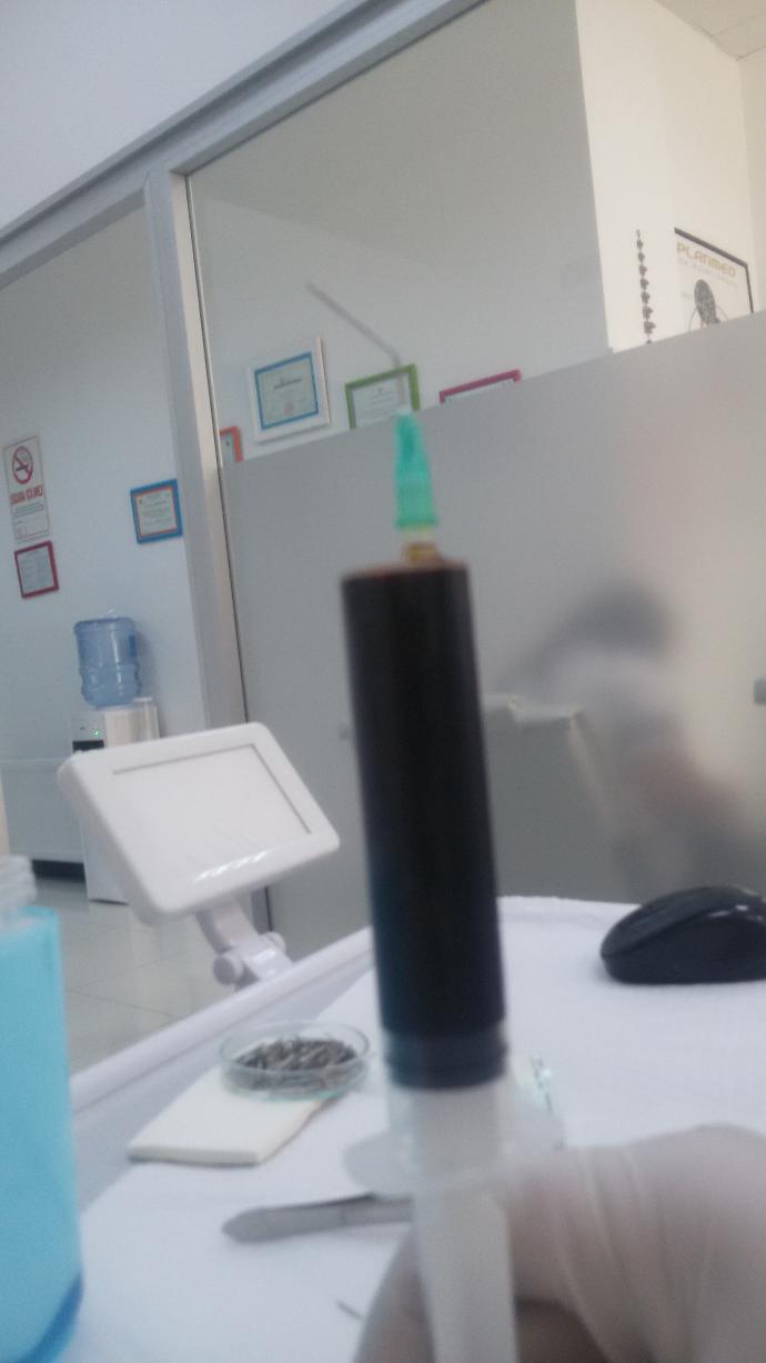 Çoğu Kişinin Korkulu Rüyası 20'lik Diş Ameliyatı