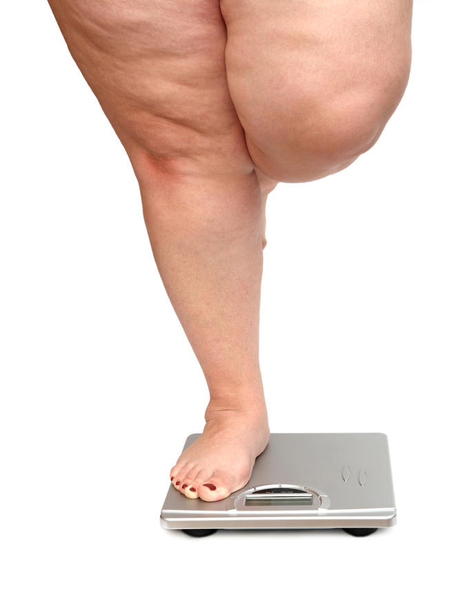 "Kilo Vermek İstiyorum Ama Veremiyorum" Diyenler Az  Bir  Toplaşın Bir Şey Anlatacağım