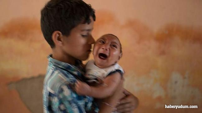 Zika Virüsü Nedir?