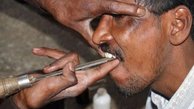 Sokak Dişçilerinden Diş Bakım ve Çekme Yöntemleri