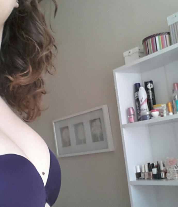 Kendi Fotoğraflarımla 5. Ay Hormon Replasman Tedavisi