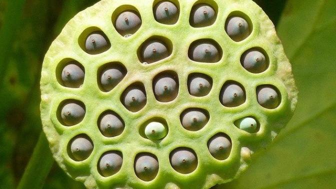 Tripofobi Sorununu Bir De Bunu Yaşayandan Dinleyin