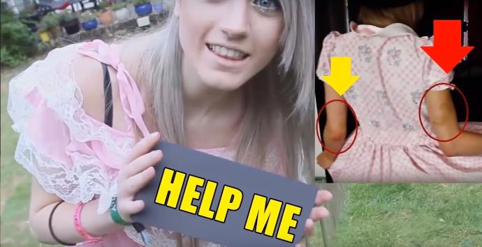 İşte Marina Joyce'nin Şizofreni Hastalığı